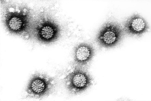 Ľudský papilomavírus